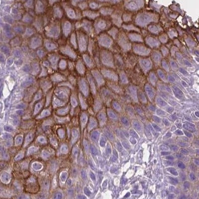 SBSN Antibody in Immunohistochemistry (IHC)