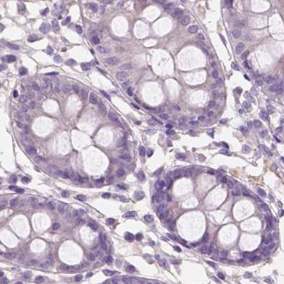 SBSN Antibody in Immunohistochemistry (IHC)