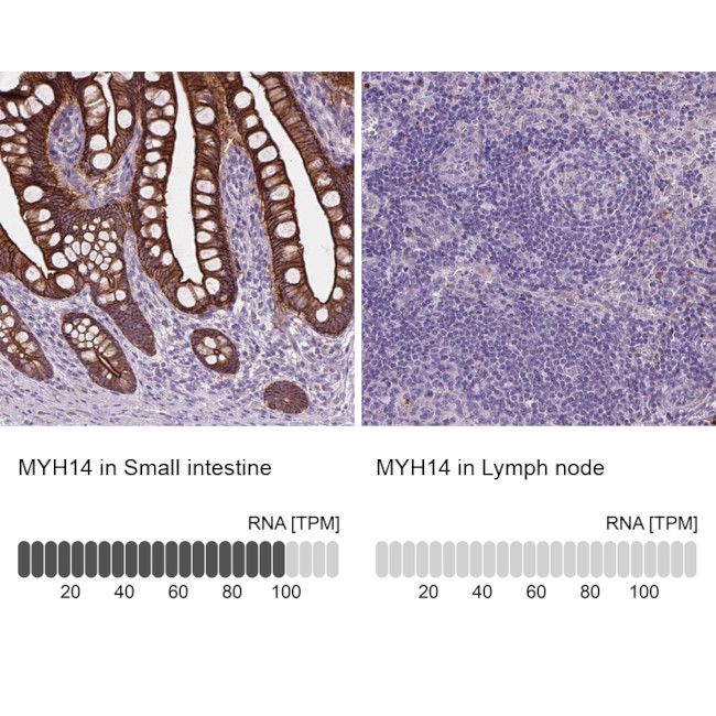 MYH14 Antibody in Immunohistochemistry (IHC)