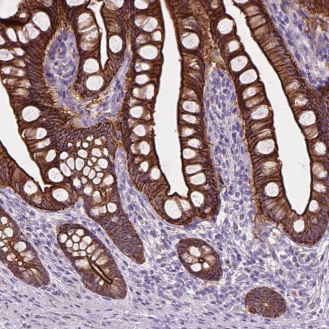 MYH14 Antibody in Immunohistochemistry (IHC)