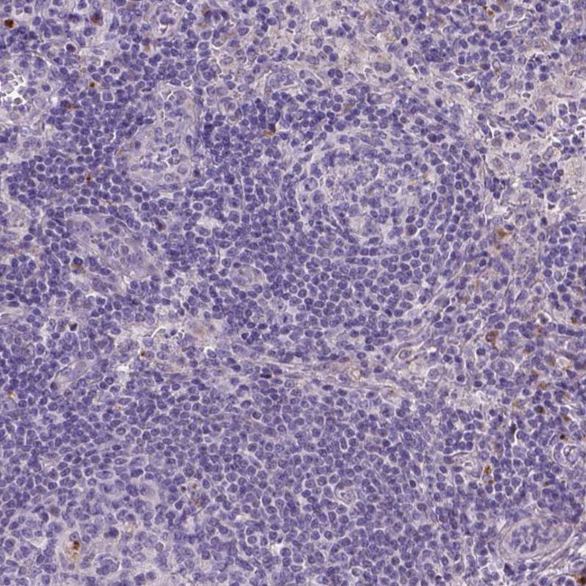 MYH14 Antibody in Immunohistochemistry (IHC)