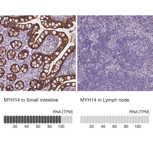 MYH14 Antibody