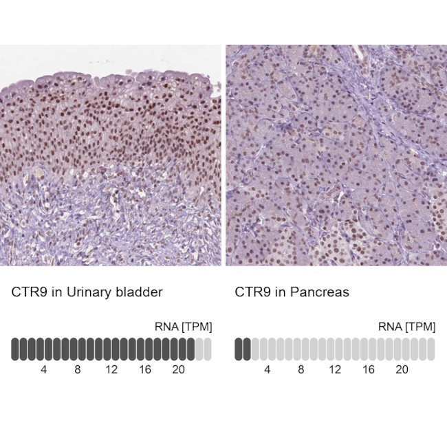 CTR9 Antibody in Immunohistochemistry (IHC)