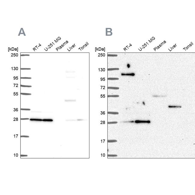 POLR2E Antibody in Western Blot (WB)