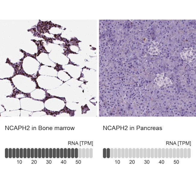 NCAPH2 Antibody in Immunohistochemistry (IHC)