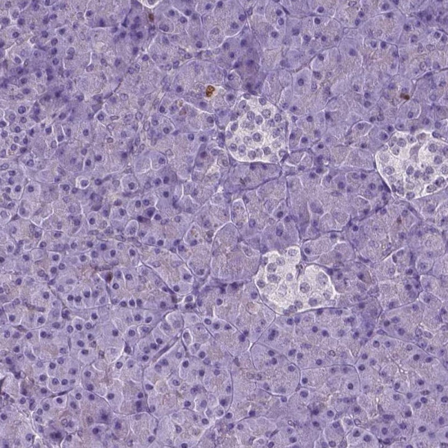 NCAPH2 Antibody in Immunohistochemistry (IHC)