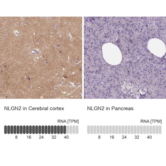 Neuroligin 2 Antibody in Immunohistochemistry (IHC)