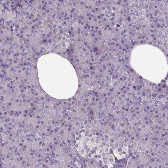 Neuroligin 2 Antibody in Immunohistochemistry (IHC)