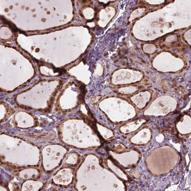 SSU72 Antibody in Immunohistochemistry (IHC)