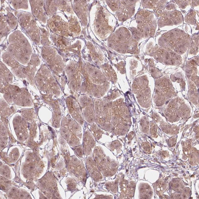 SSU72 Antibody in Immunohistochemistry (IHC)