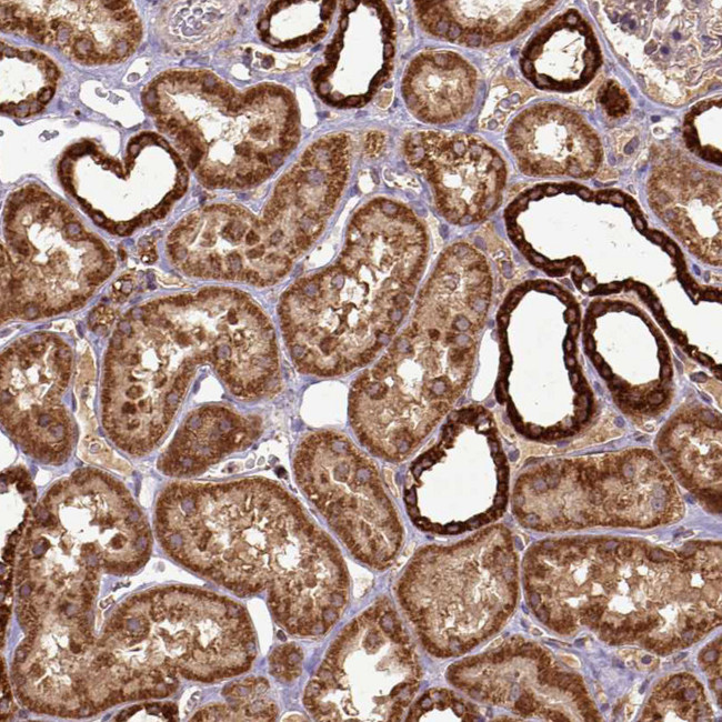 MTCO1 Antibody in Immunohistochemistry (IHC)