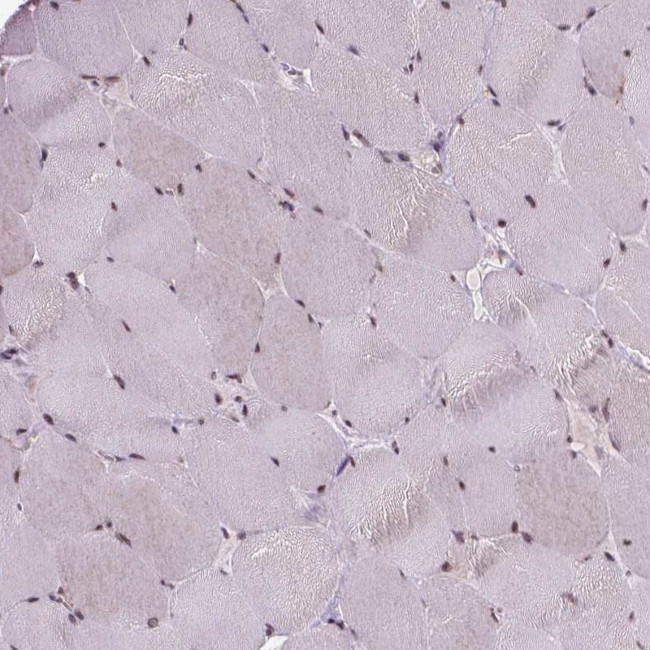 EAF1 Antibody in Immunohistochemistry (IHC)