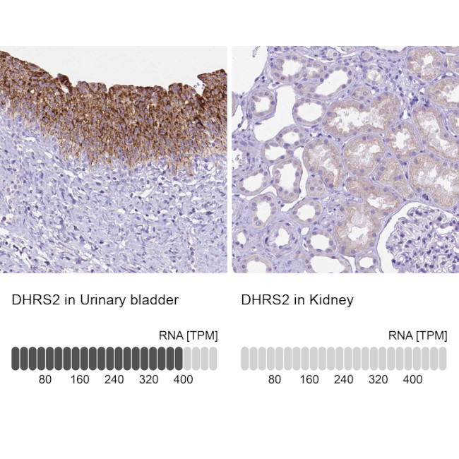 DHRS2 Antibody in Immunohistochemistry (IHC)