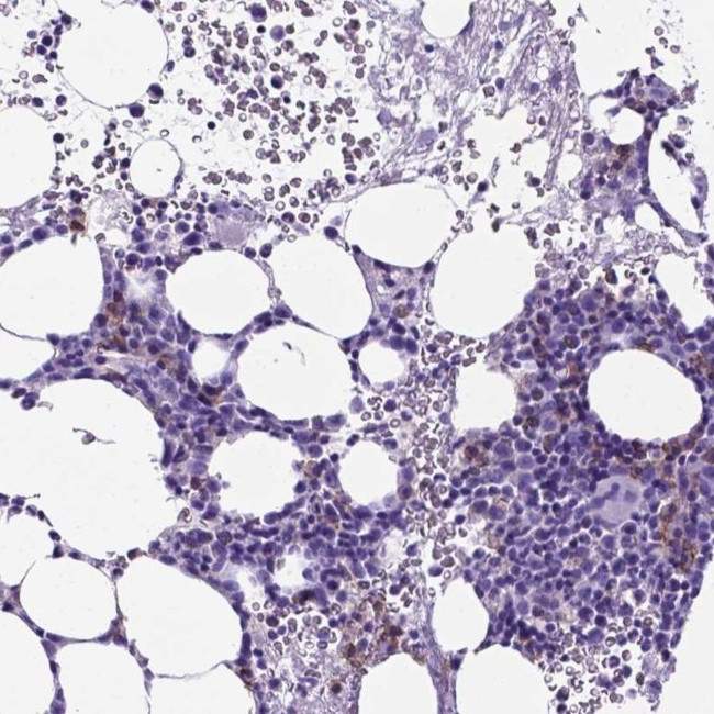 CD94 Antibody in Immunohistochemistry (IHC)