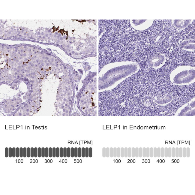 LELP1 Antibody in Immunohistochemistry (IHC)