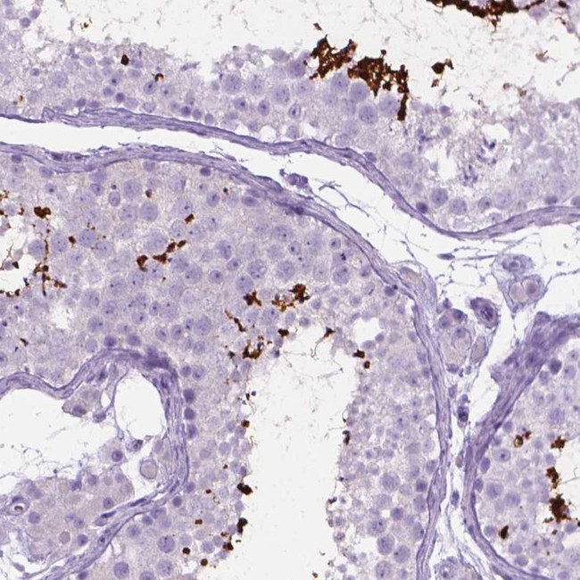 LELP1 Antibody in Immunohistochemistry (IHC)