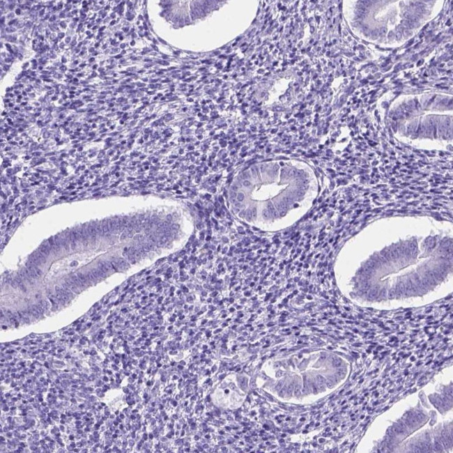 LELP1 Antibody in Immunohistochemistry (IHC)