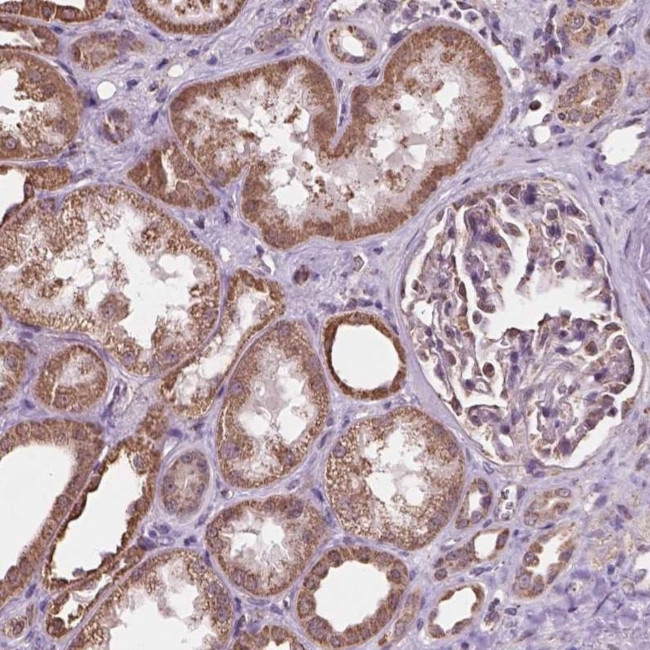 SCOC Antibody in Immunohistochemistry (IHC)