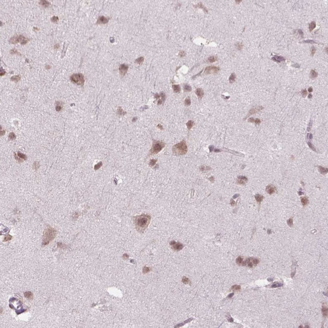 PHAX Antibody in Immunohistochemistry (IHC)