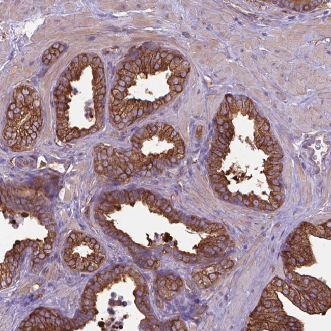 Coronin 1B Antibody in Immunohistochemistry (IHC)