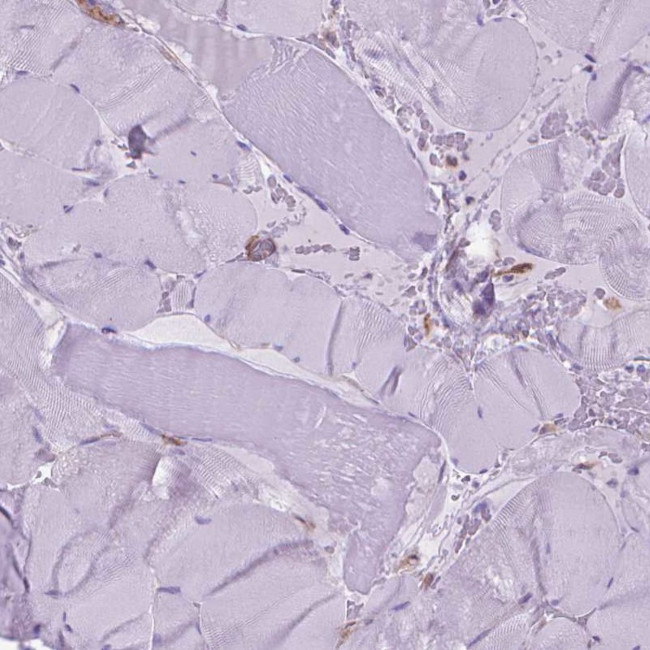 Coronin 1B Antibody in Immunohistochemistry (IHC)