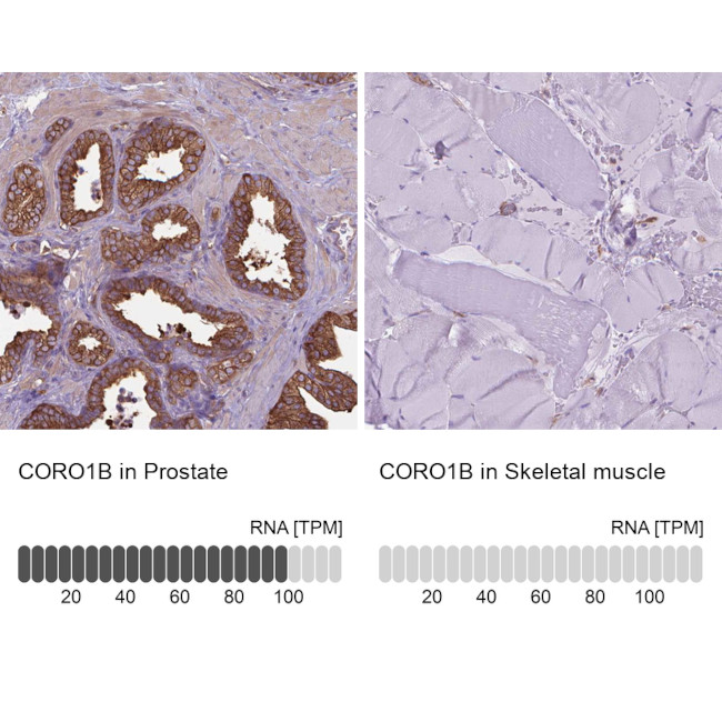 Coronin 1B Antibody