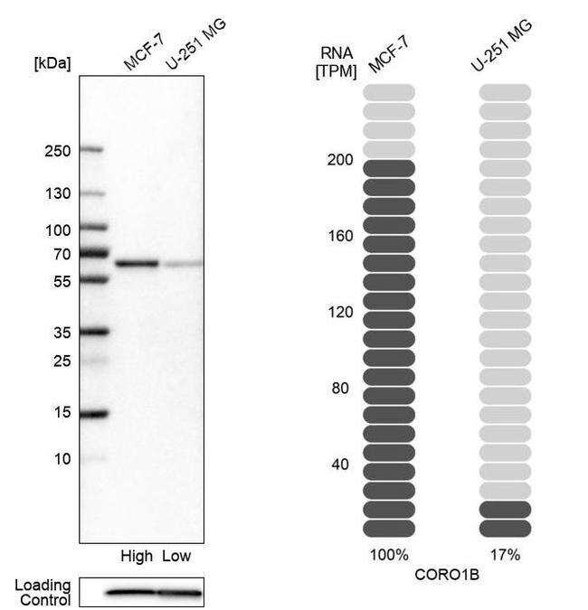 Coronin 1B Antibody in Western Blot (WB)