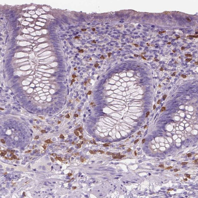 CD84 Antibody in Immunohistochemistry (IHC)