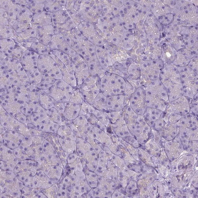 CD84 Antibody in Immunohistochemistry (IHC)