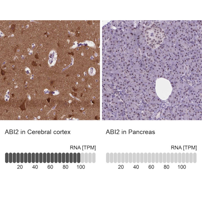 ABI2 Antibody in Immunohistochemistry (IHC)