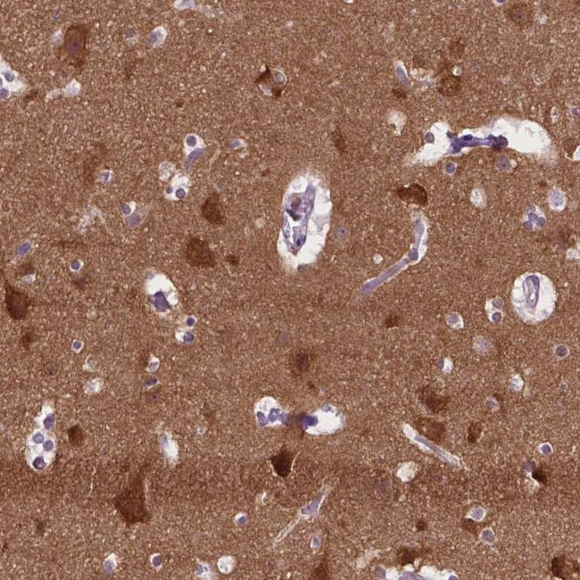 ABI2 Antibody in Immunohistochemistry (IHC)