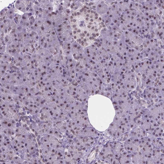 ABI2 Antibody in Immunohistochemistry (IHC)