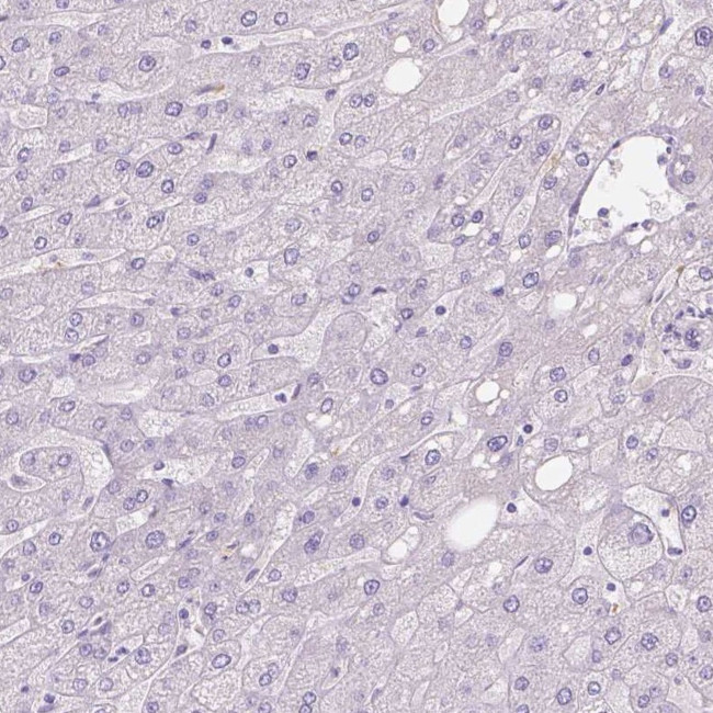 GAL3ST2 Antibody in Immunohistochemistry (IHC)