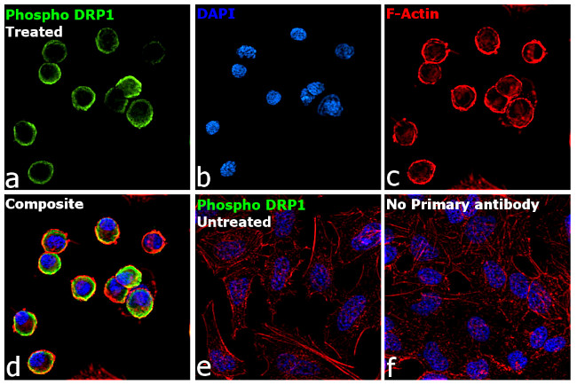 Phospho-DRP1 (Ser616) Antibody in Immunocytochemistry (ICC/IF)