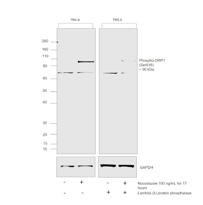 Phospho-DRP1 (Ser616) Antibody