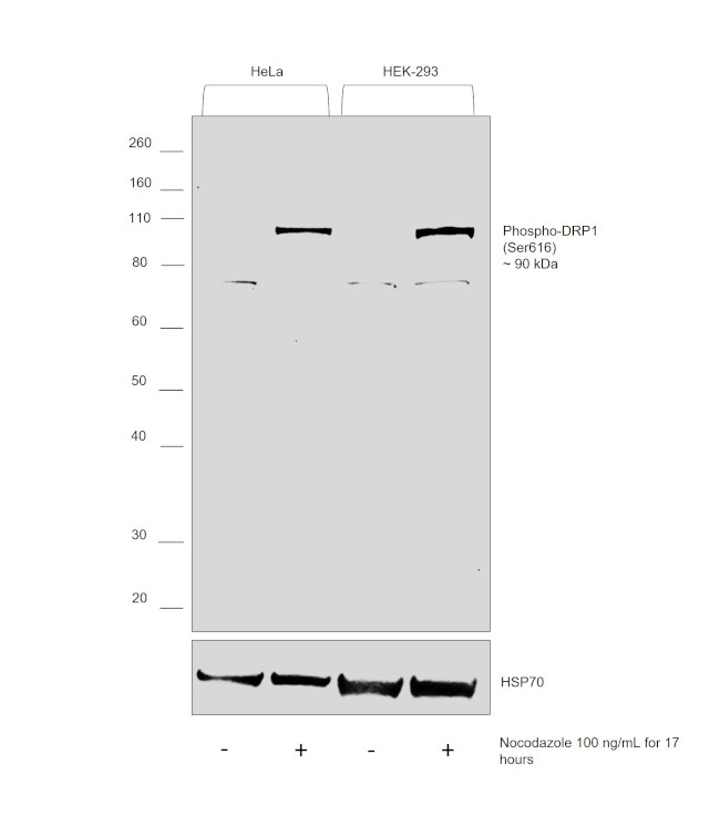 Phospho-DRP1 (Ser616) Antibody in Western Blot (WB)