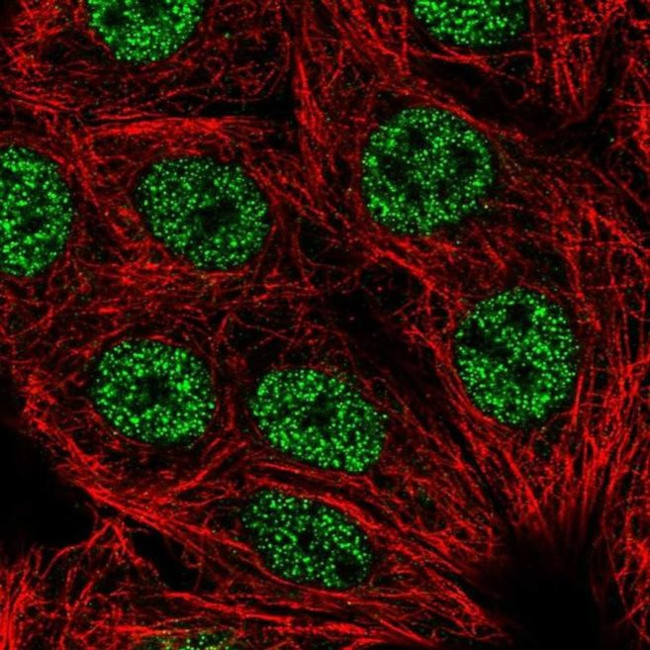 LHX2 Antibody in Immunocytochemistry (ICC/IF)