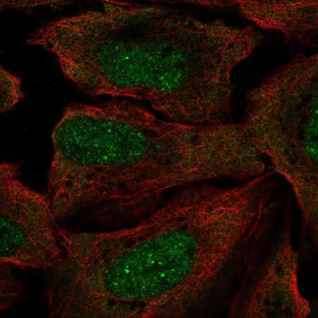 RP2 Antibody in Immunocytochemistry (ICC/IF)