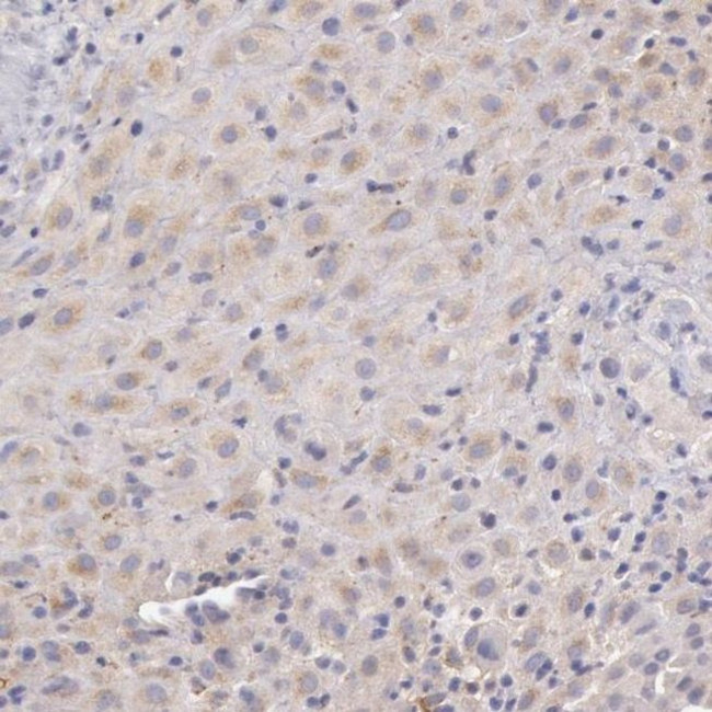 C1r Antibody in Immunohistochemistry (IHC)