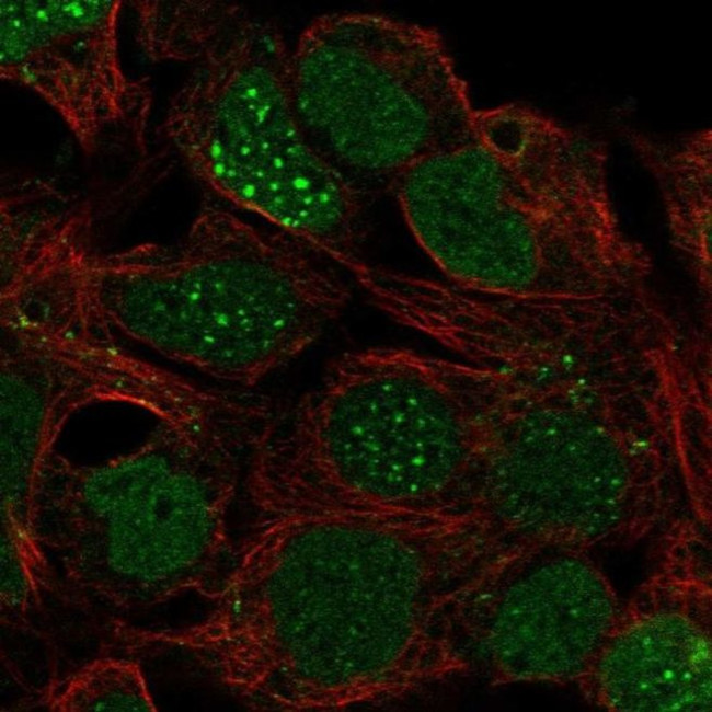 LBX1 Antibody in Immunocytochemistry (ICC/IF)