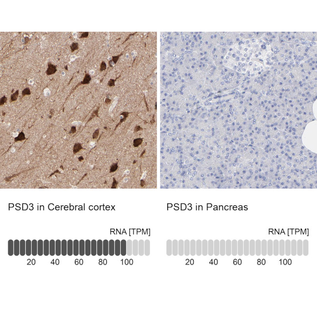 PSD3 Antibody in Immunohistochemistry (IHC)
