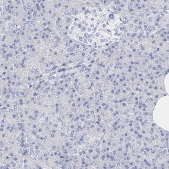 PSD3 Antibody in Immunohistochemistry (IHC)