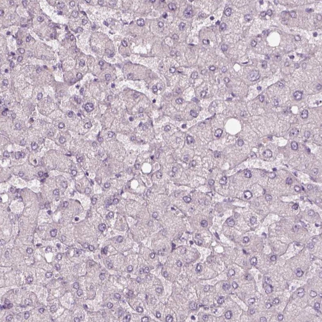 CACNG4 Antibody in Immunohistochemistry (IHC)