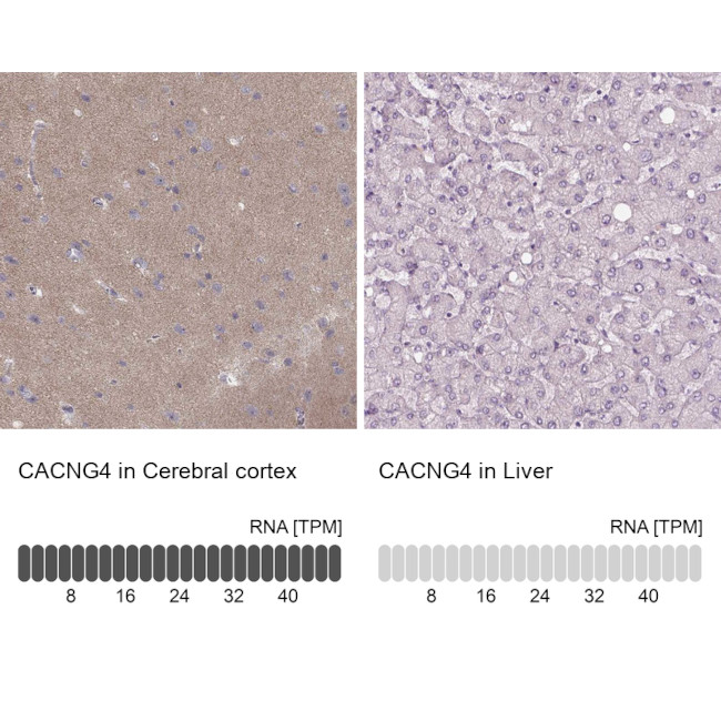 CACNG4 Antibody