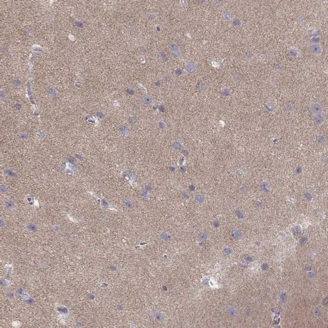 CACNG4 Antibody in Immunohistochemistry (IHC)