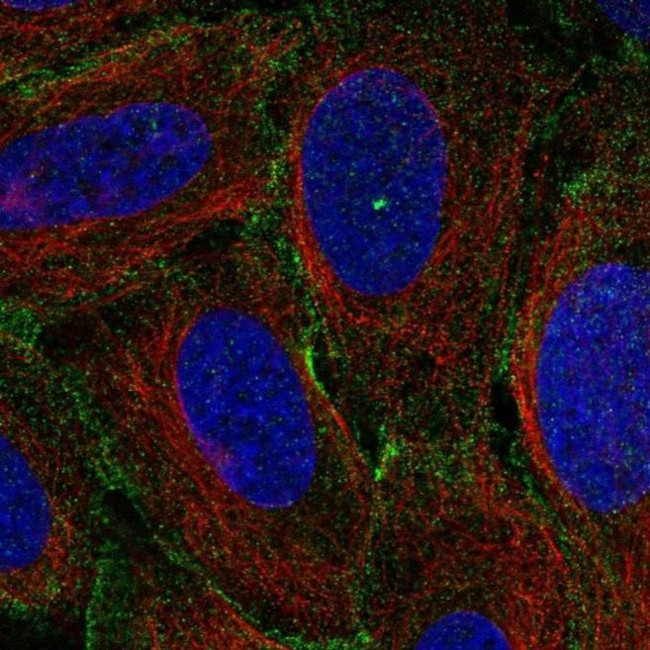 MYO1C Antibody in Immunocytochemistry (ICC/IF)