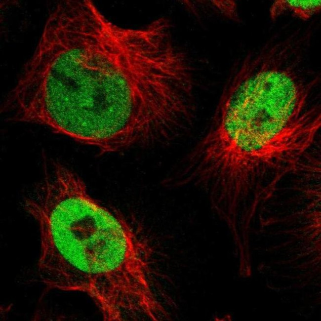 NFIX Antibody in Immunocytochemistry (ICC/IF)