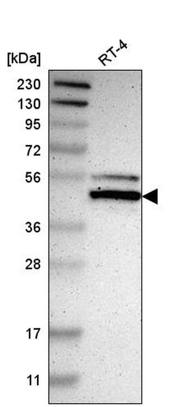 NFIX Antibody in Western Blot (WB)