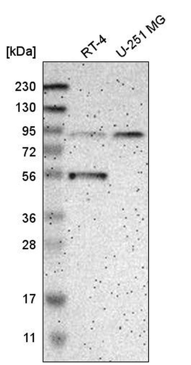 GCS1 Antibody in Western Blot (WB)