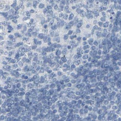 Opsin Blue Antibody in Immunohistochemistry (IHC)